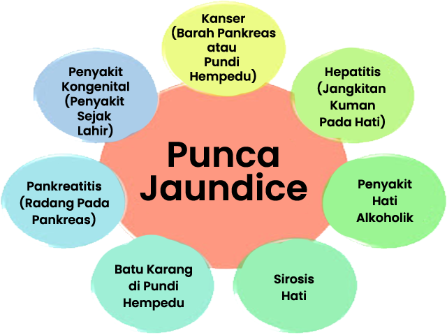 PUNCA-PUNCA BERLAKU JAUNDICE(PENYAKIT KUNING)